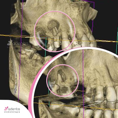 Diagnostyka Cbct Rtg Cefalometria Rtg Pa Pantomogram Warszawa