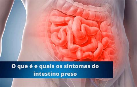 O Que Intestino Preso E Como Tratar