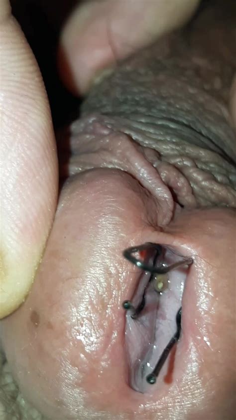 A Small Worm Sinks Into My Urethra Then A Bigger One