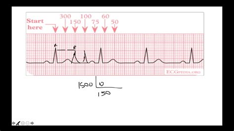 Medir Frecuencia Cardiaca Ecg Estudiar