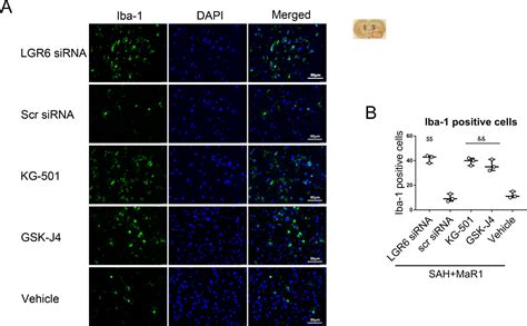 Maresin Activates Lgr To Alleviate Neuroinflammation Via The Creb