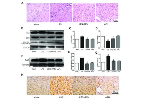 The Effects Of APN On Sepsis Induced Myocardial Injury A HE