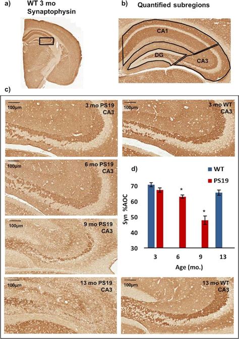 Synaptophysin Immunostaining And Quantification Of Presynapse Density