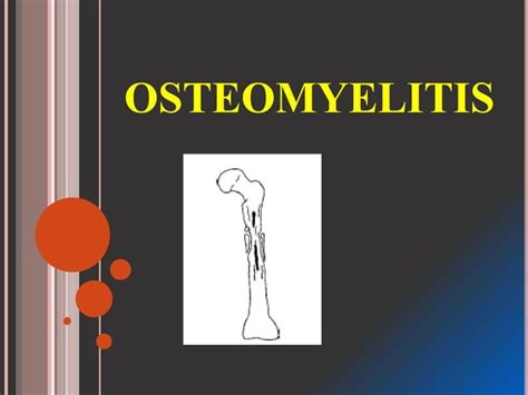 Osteomyelitis Types Clinic Features And Treatmentpptx