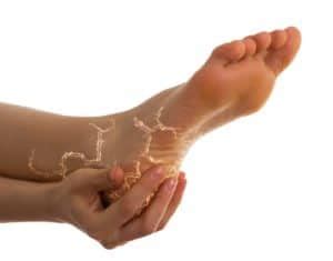 Neurontin (gabapentin) - Beaver Valley Foot Clinic