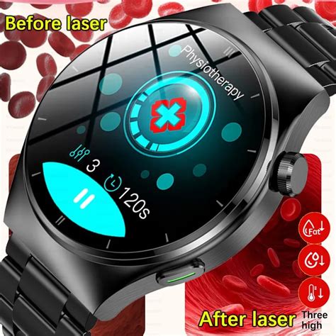 Blood Lipids Uric Acid Blood Glucose Smart Watch Men Amoled Screen