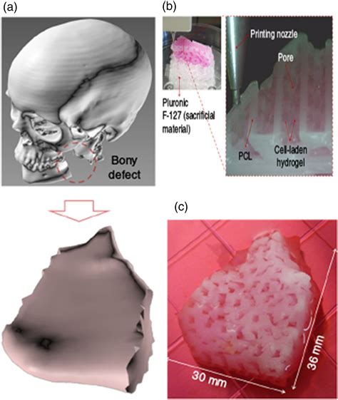 Hydrogels Provide Microenvironments To Mesenchymal Stem Cells For