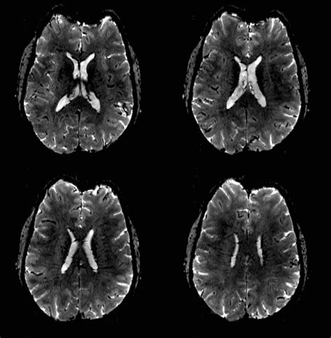 Low Versus Ultra High Field MRI How To Select Your MRI Fleet Applied