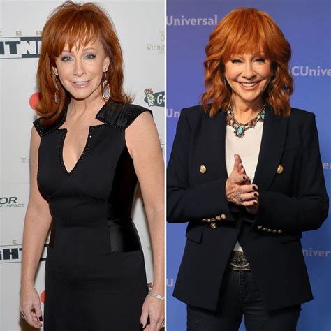 reba mcentire plastic surgery