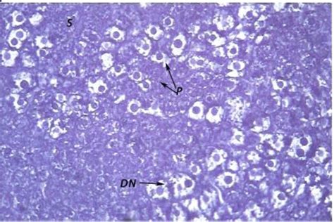 A Photomicrograph Of A Liver Section Of A Rat Obtained 30 Days