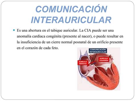 Cierre De Comunicaci N Interauricular Ppt