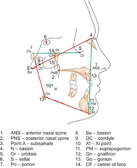 A: Cephalometric landmarks used on lateral cephalogram | Download Scientific Diagram