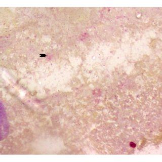 gram negative bacilli   abscess arrow head gram stain