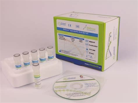 Hla B27 Test Kit Eg 90060 Rt Elisabeth Pharmacon Spol Spa Blood