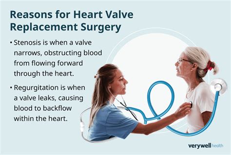 Heart Valve Replacement Options for Heart Disease