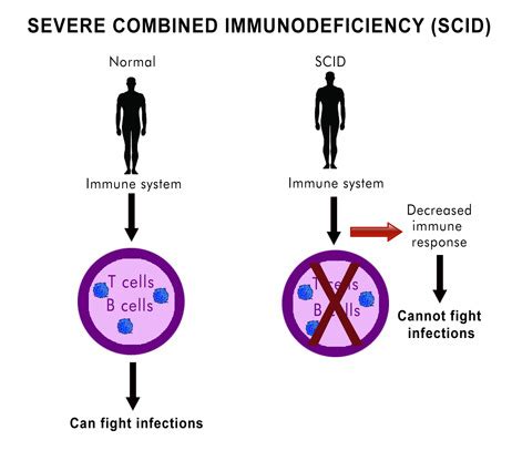 Severe Combined Immunodeficiency Disorder Diagram Quizlet