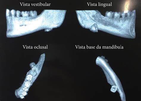 Computed Tomography 3d Reconstruction Download Scientific Diagram