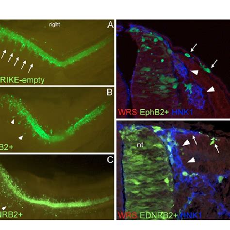 Overexpression Of EphB2 Or EDNRB2 In The Neurogenic Crest Leads To