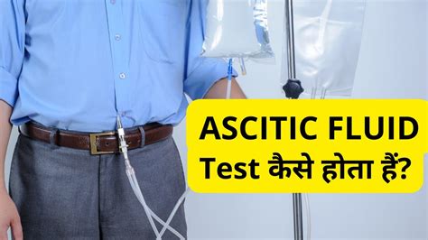 Ascitic Fluid Test in Hindi Ascitic Fluid Analysis Procedure स कय