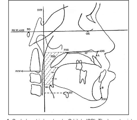 Figure 1 From Cephalometric Evaluation Of The Pharyngeal Airway Space