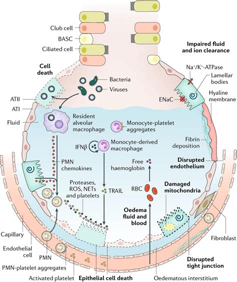 Frontiers Gene Therapy For Acute Respiratory Distress Syndrome