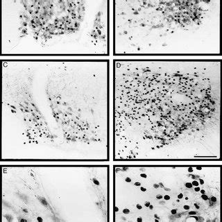 Staining Of Fos And Vasopressin Vp Or Oxytocin Ot In Hypothalamic