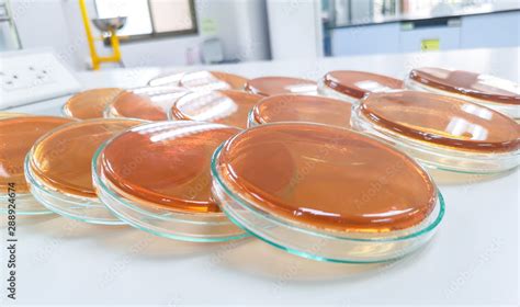 Salmonella Shigella Agar Ss Agar Stock Photo Adobe Stock