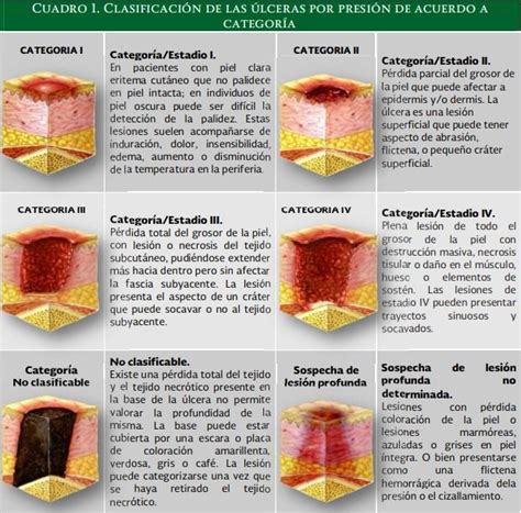 Curso Taller De Ulceras Por Presion Taller Lceras Por Presi N