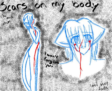 Scars on my body by TessuSaysHi on DeviantArt