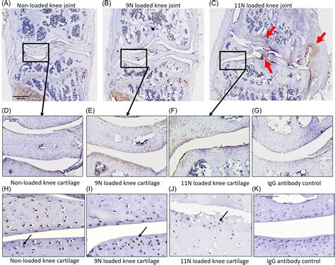 Expression Of Semaphorin3A In The Joint And Role In Osteoarthritis