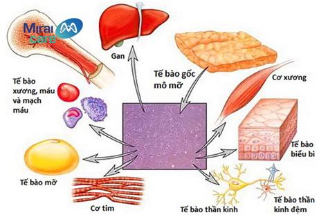 Cấy Ghép Tế Bào Gốc Tự Thân Chi Phí Và Quy Trình Mirai Care