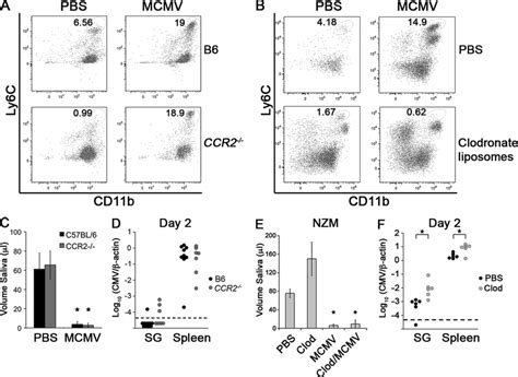 MCMV Induced Inflammatory Monocyte Recruitment To SG Is CCR2