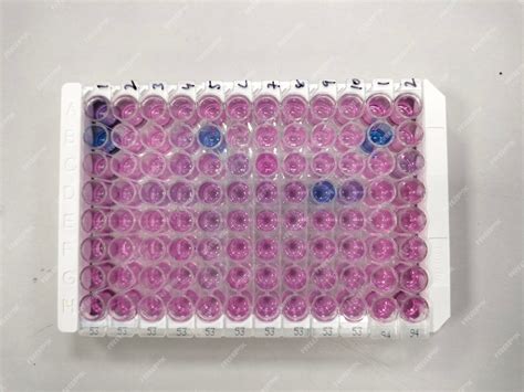 Premium Photo Enzyme Linked Immunosorbent Assay Elisa Plate