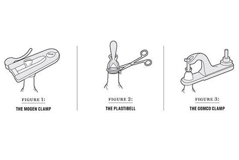 Anatomy Of A Circumcision New York Magazine Nymag Circumcision