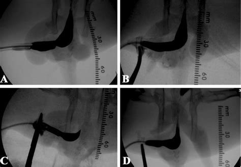 Retrograde Urethrogram Rug A Group 1 Pre Treatment Rug B Group 1 Download Scientific