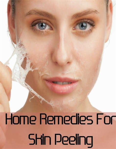 Home Remedies For Lost Voice Dry Skin On Face Peeling Skin Chemical Skin Peel