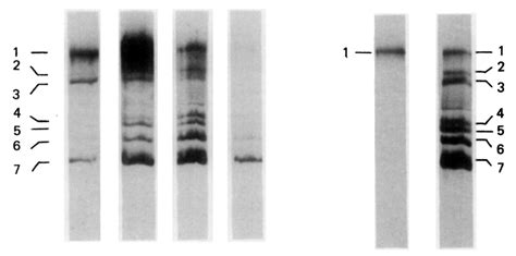 Agarose Gel Electrophoresis Of Glyoxal Me So Denatured Rna Extracted