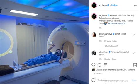 ari lasso jalani operasi pet scan  kondisi terbarunya merdekacom