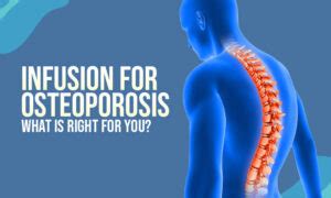 Is Infusion for Osteoporosis Helpful for You?