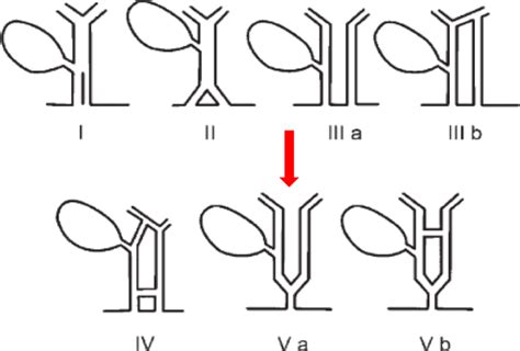 Modified Double Common Bile Duct Classification Proposed By Choi Et Al