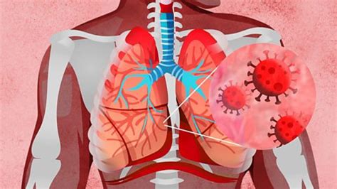 Korona Virus I Srbija Za To Nema Novog Karantina Uprkos Rastu Broja