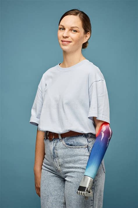 Positive Woman With Prosthetic Arm Stock Image Image Of Lifestyle