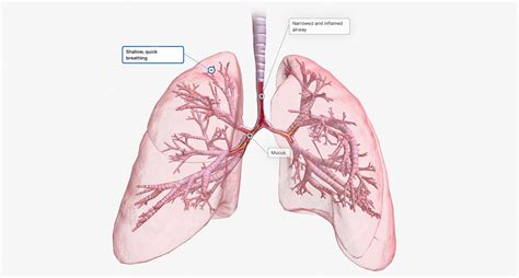 Premium Photo | The narrowed and inflamed airway