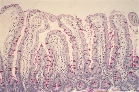 Small Intestine Lining Light Micrograph Stock Image C0227102 Science Photo Library