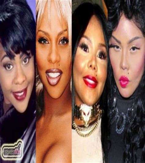 Worst Cases Of Celebrity Plastic Surgery Gone Wrong