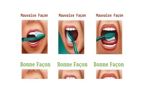 Comment Bien Se Brosser Les Dents Vid O Source Shop