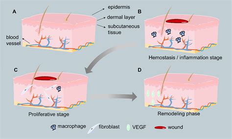 Smart Microneedle Patches For Wound Healing And Management Journal Of