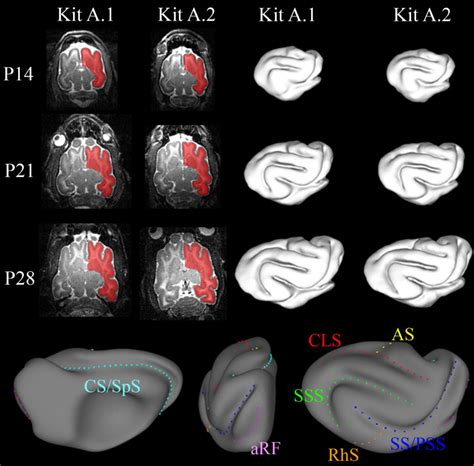 Figure 3 from A new method to measure cortical growth in the developing ... 