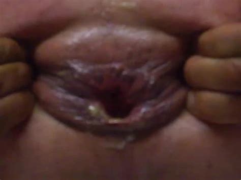 My Deep Anal Gay Man Man Porn Xhamster