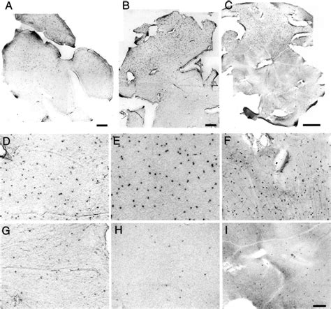 Melanopsin And Pacap Expression In The Rat Retina In Situ